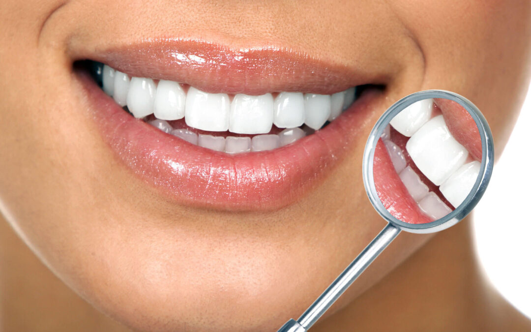 Tips on How to Keep Your Teeth Healthy and Clean